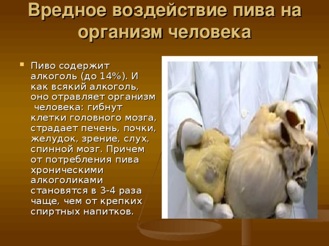 Вредное воздействие пива на организм человека   Пиво содержит алкоголь (до 14%). И как всякий алкоголь, оно отравляет организм человека: гибнут клетки головного мозга, страдает печень, почки, желудок, зрение, слух, спинной мозг. Причем от потребления пива хроническими алкоголиками становятся в 3-4 раза чаще, чем от крепких спиртных напитков.  