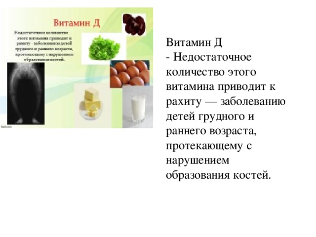 Витамин Д  - Недостаточное количество этого витамина приводит к рахиту — заболеванию детей грудного и раннего возраста, протекающему с нарушением образования костей. 