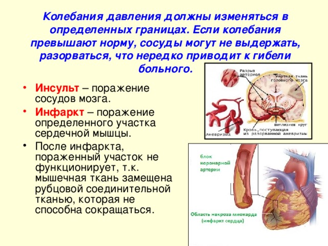 Схема аномалии кровяного давления