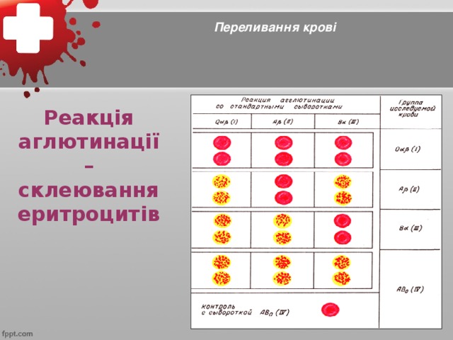 Переливання крові Реакція аглютинації – склеювання еритроцитів