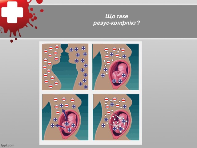 Що таке резус-конфлікт?