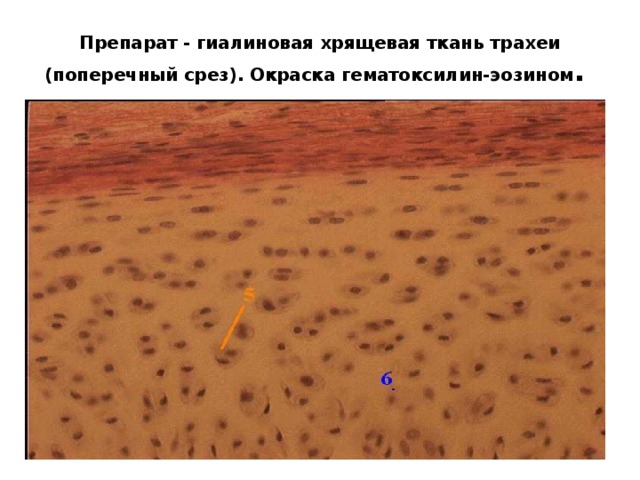 Препарат - гиалиновая хрящевая ткань трахеи (поперечный срез). Окраска гематоксилин-эозином . 