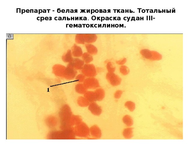 Препарат - белая жировая ткань. Тотальный срез сальника . Окраска судан III-гематоксилином. 