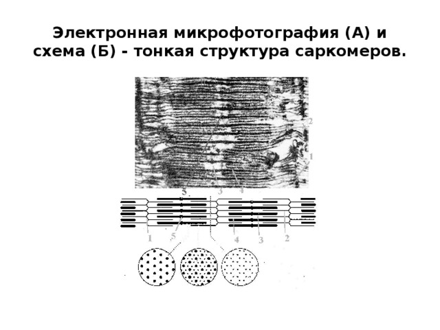 Электронная микрофотография (А) и схема (Б) - тонкая структура саркомеров. 