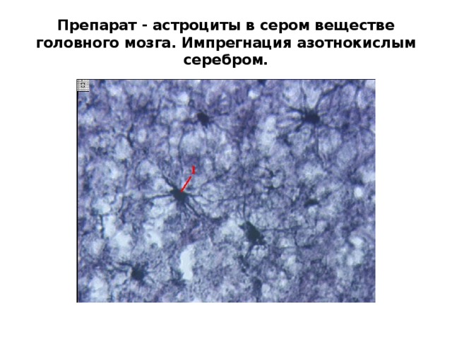 Препарат - астроциты в сером веществе головного мозга. Импрегнация азотнокислым серебром. 