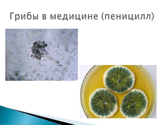 Какой организм изображен на рисунке бактерия дрожжи пеницилл подберезовик