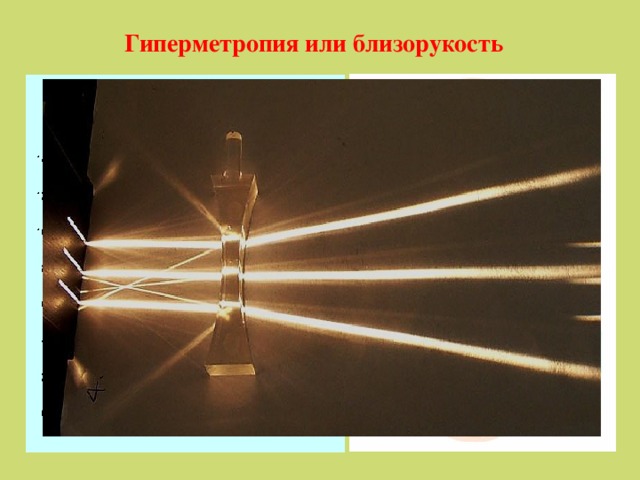 Гиперметропия или близорукость 