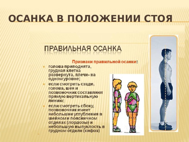 Осанка в положении стоя 