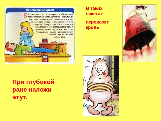 В таких пакетах перевозят кровь При глубокой ране наложи жгут. 