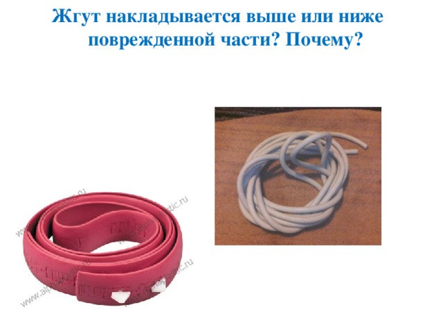 Жгут накладывается выше или ниже поврежденной части? Почему? 