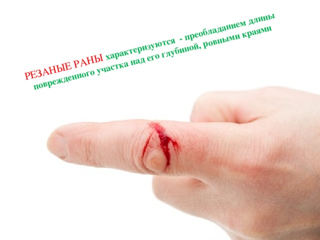 РЕЗАНЫЕ РАНЫ характеризуются - преобладанием длины поврежденного участка над его глубиной, ровными краями   