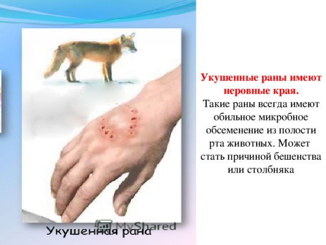Укушенные раны имеют неровные края.  Такие раны всегда имеют обильное микробное обсеменение из полости рта животных. Может стать причиной бешенства или столбняка 