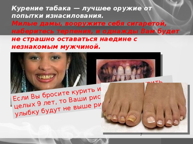 Если Вы бросите курить и не будете курить целых 9 лет, то Ваши риски получить такую улыбку будут не выше риска обычных людей Курение табака — лучшее оружие от попытки изнасилования.  Милые дамы, вооружите себя сигаретой, наберитесь терпения, и однажды Вам будет не страшно оставаться наедине с незнакомым мужчиной.  