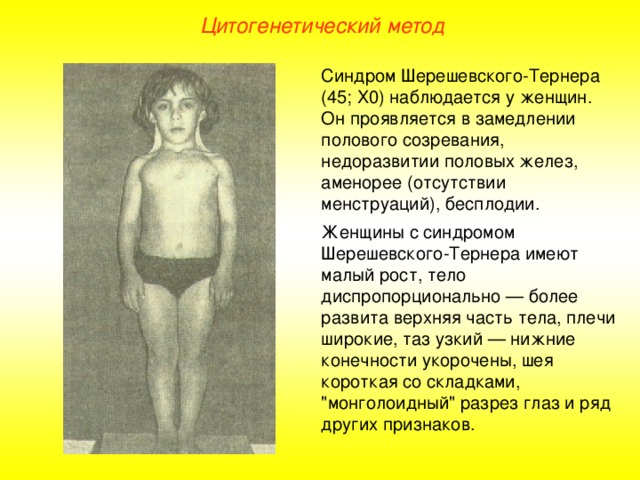 Цитогенетический метод Синдром Шерешевского-Тернера (45; Х0) наблюдается у женщин. Он проявляется в замедлении полового созревания, недоразвитии половых желез, аменорее (отсутствии менструаций), бесплодии. Женщины с синдромом Шерешевского-Тернера имеют малый рост, тело диспропорционально — более развита верхняя часть тела, плечи широкие, таз узкий — нижние конечности укорочены, шея короткая со складками, 