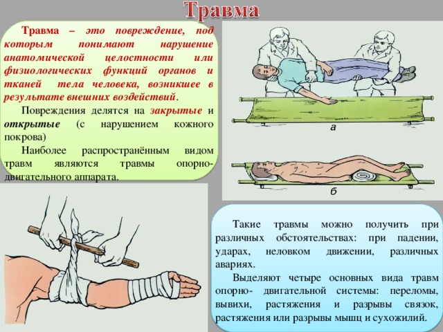 Примеры ситуаций при которых можно получить травму