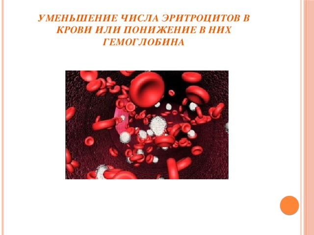 Уменьшение числа эритроцитов в крови или понижение в них гемоглобина