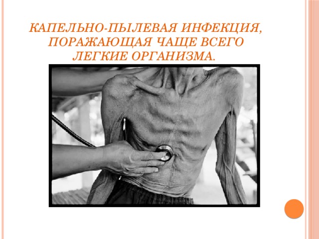 Капельно-пылевая инфекция, поражающая чаще всего легкие организма.