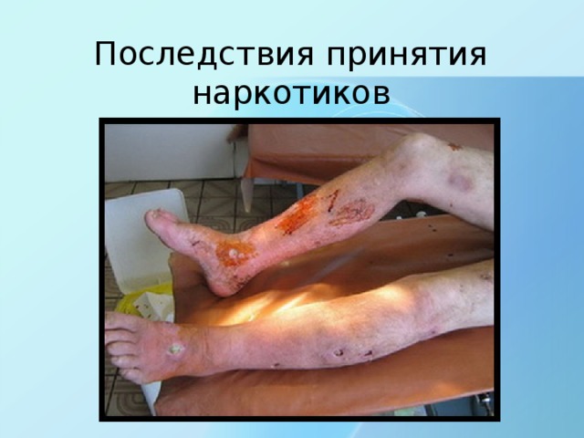 Последствия принятия наркотиков