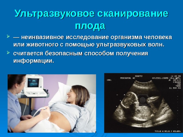 Ультразвуковое сканирование плода  — неинвазивное исследование организма человека или животного с помощью ультразвуковых волн. считается безопасным способом получения информации.  