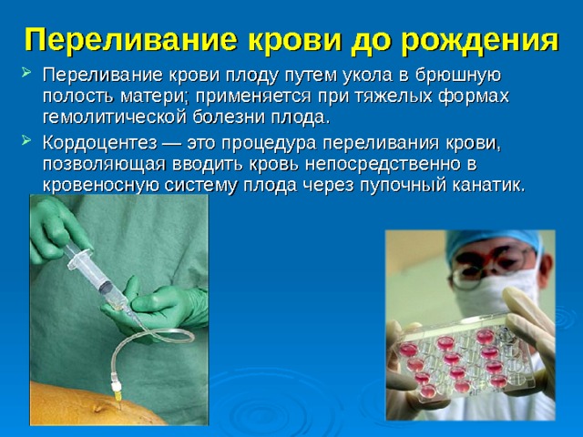 Переливание крови до рождения   Переливание крови плоду путем укола в брюшную полость матери; применяется при тяжелых формах гемолитической болезни плода. Кордоцентез — это процедура переливания крови, позволяющая вводить кровь непосредственно в кровеносную систему плода через пупочный канатик.  