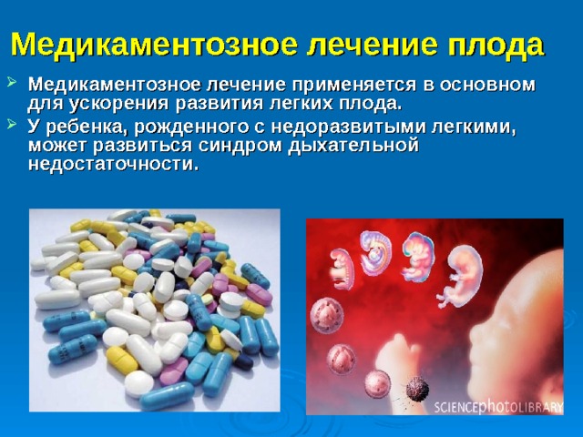 Медикаментозное лечение плода   Медикаментозное лечение применяется в основном для ускорения развития легких плода. У ребенка, рожденного с недоразвитыми легкими, может развиться синдром дыхательной недостаточности. 