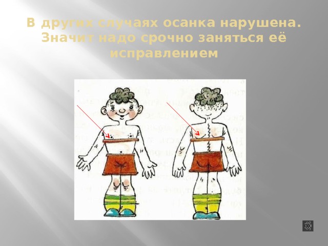 В других случаях осанка нарушена.  Значит надо срочно заняться её исправлением  