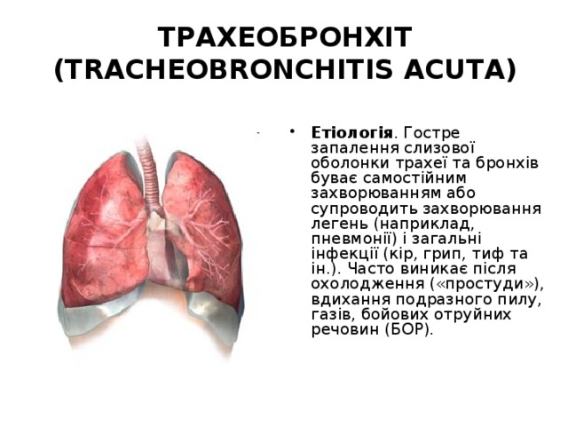 ТРАХЕОБРОНХІТ (TRACHEOBRONCHITIS ACUTА) Етіологія . Гостре запалення слизової оболонки трахеї та бронхів буває самостійним захворюванням або супроводить захворювання легень (наприклад, пневмонії) і загальні інфекції (кір, грип, тиф та ін.). Часто виникає після охолодження («простуди»), вдихання подразного пилу, газів, бойових отруйних речовин (БОР). 