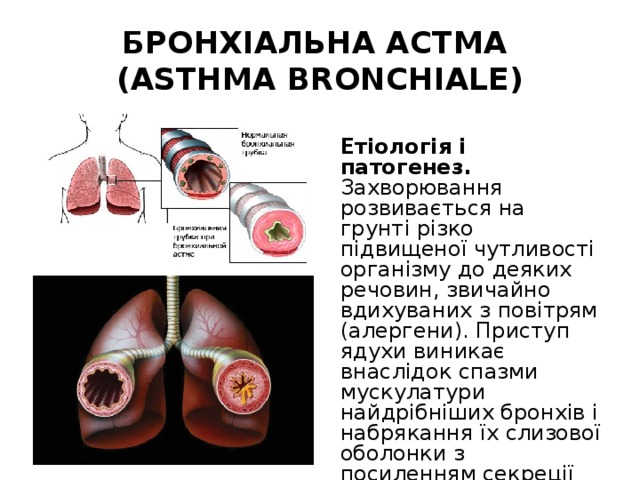 БРОНХІАЛЬНА АСТМА  (ASTHMA BRONCHIALE) Етіологія і патогенез. Захворювання розвивається на грунті різко підвищеної чутливості організму до деяких речовин, звичайно вдихуваних з повітрям (алергени). Приступ ядухи виникає внаслідок спазми мускулатури найдрібніших бронхів і набрякання їх слизової оболонки з посиленням секреції слизу. 