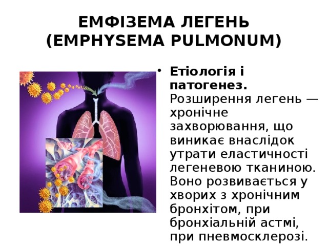 ЕМФІЗЕМА ЛЕГЕНЬ (EMPHYSEMA PULMONUM) Етіологія і патогенез. Розширення легень — хронічне захворювання, що виникає внаслідок утрати еластичності легеневою тканиною. Воно розвивається у хворих з хронічним бронхітом, при бронхіальній астмі, при пневмосклерозі. 