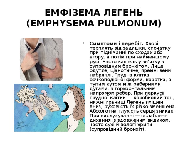 ЕМФІЗЕМА ЛЕГЕНЬ (EMPHYSEMA PULMONUM) Симптоми і перебіг. Хворі терплять від задишки, спочатку при підніманні по сходах або вгору, а потім при найменшому русі. Часто кашель у зв'язку з супровідним бронхітом. Лице одутле, ціанотичне, яремні вени набряклі. Грудна клітка бочкоподібної форми, коротка, з тупим кутом між реберними дугами, з горизонтальним напрямом ребер. При перкусії грудної клітки — коробковий тон, нижні границі Легень зміщені вниз, рухомість їх різко зменшена. Абсолютна глухість серця зникає. При вислухуванні — ослаблене дихання із здовженим видихом, часто сухі й вологі хрипи (супровідний бронхіт). 
