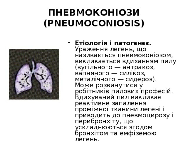 ПНЕВМОКОНІОЗИ (PNEUMOCONIOSIS) Етіологія і патогєнєз. Ураження легень, що називається пневмоконіозом, викликається вдиханням пилу (вугільного — антракоз, вапняного — силікоз, металічного — сидероз). Може розвинутися у робітників пилових професій. Вдихуваний пил викликає реактивне запалення проміжної тканини легені і приводить до пневмоцирозу і перибронхіту, що ускладнюються згодом бронхітом та емфіземою легень. 
