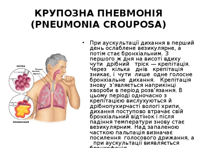 КРУПОЗНА ПНЕВМОНІЯ (PNEUMONIA CROUPOSA) При аускультації дихання в перший день ослаблене везикулярне, а потім стає бронхіальним. З першого ж дня на висоті вдиху чути дрібний тріск — крепітація. Через кілька днів крепітація зникає, і чути лише одне голосне бронхіальне дихання. Крепітація знову з'являється наприкінці хвороби в період розв'язання. В цьому періоді одночасно з крепітацією вислухуються й дрібнопухирчасті вологі хрипи, дихання поступово втрачає свій бронхіальний відтінок і після падіння температури знову стає везикулярним. Над запаленою часткою пальпація визначає посилення голосового дрижання, а при аускультації виявляється бронхофонія. 