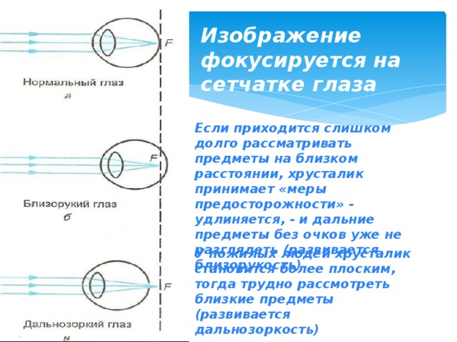 Фокусировку изображения обеспечивает