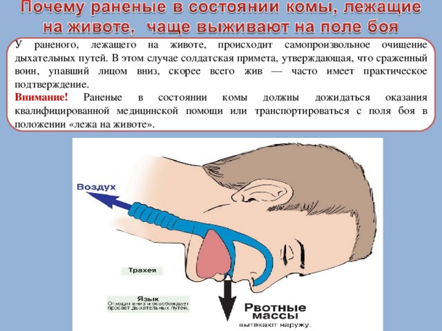 У раненого, лежащего на животе, происходит самопроизвольное очищение дыхательных путей. В этом случае солдатская примета, утверждающая, что сраженный воин, упавший лицом вниз, скорее всего жив — часто имеет практическое подтверждение. Внимание! Раненые в состоянии комы должны дожидаться оказания квалифицированной медицинской помощи или транспортироваться с поля боя в положении «лежа на животе». 