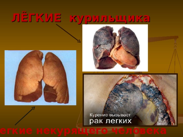 ЛЁГКИЕ курильщика Легкие некурящего человека 