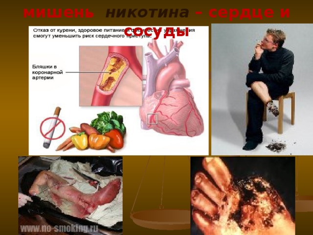 мишень никотина – сердце и сосуды 