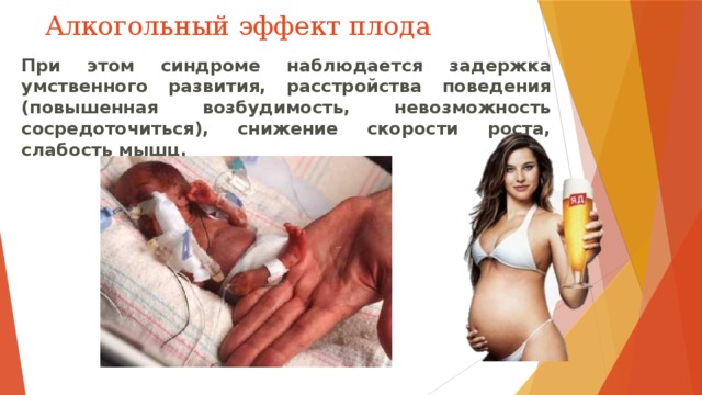Алкогольный эффект плода При этом синдроме наблюдается задержка умственного развития, расстройства поведения (повышенная возбудимость, невозможность сосредоточиться), снижение скорости роста, слабость мышц. 