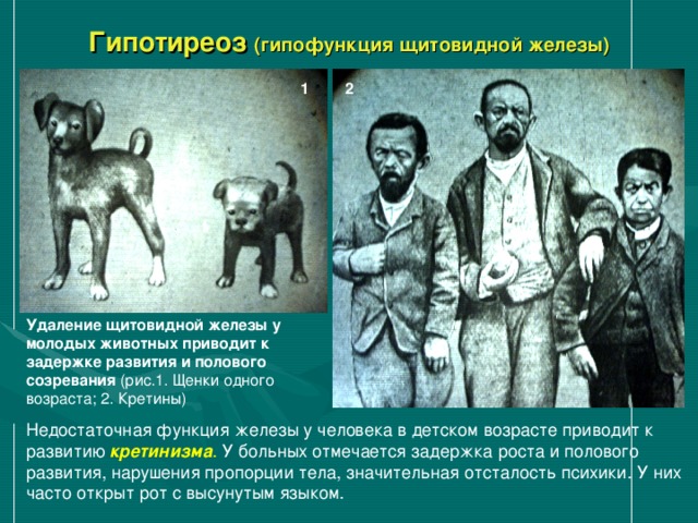 Гипотиреоз (гипофункция щитовидной железы) 1 2 Удаление щитовидной железы у молодых животных приводит к задержке развития и полового созревания (рис.1. Щенки одного возраста; 2. Кретины) кретинизма . 