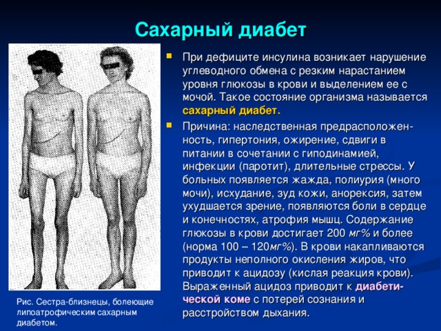 Сахарный диабет При дефиците инсулина возникает нарушение углеводного обмена с резким нарастанием уровня глюкозы в крови и выделением ее с мочой. Такое состояние организма называется сахарный диабет. Причина: наследственная предрасположен-ность, гипертония, ожирение, сдвиги в питании в сочетании с гиподинамией, инфекции (паротит), длительные стрессы. У больных появляется жажда, полиурия (много мочи), исхудание, зуд кожи, анорексия, затем ухудшается зрение, появляются боли в сердце и конечностях, атрофия мышц. Содержание глюкозы в крови достигает 200 мг% и более (норма 100 – 120 мг% ). В крови накапливаются продукты неполного окисления жиров, что приводит к ацидозу (кислая реакция крови). Выраженный ацидоз приводит к диабети-ческой коме с потерей сознания и расстройством дыхания.  Рис. Сестра-близнецы, болеющие липоатрофическим сахарным диабетом. 