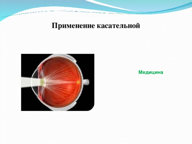 Применение касательной   Медицина