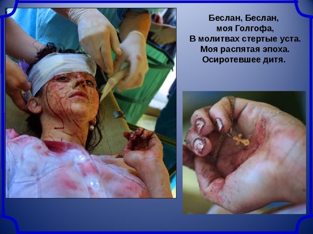  Беслан, Беслан, моя Голгофа,  В молитвах стертые уста.  Моя распятая эпоха.  Осиротевшее дитя. 