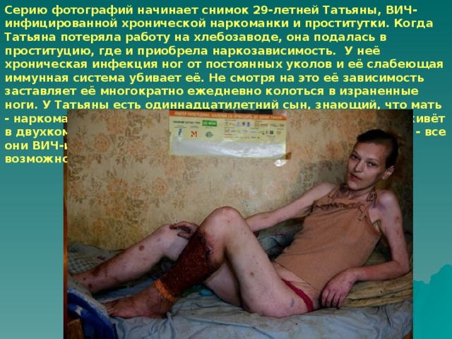 Серию фотографий начинает снимок 29-летней Татьяны, ВИЧ-инфицированной хронической наркоманки и проститутки. Когда Татьяна потеряла работу на хлебозаводе, она подалась в проституцию, где и приобрела наркозависимость. У неё хроническая инфекция ног от постоянных уколов и её слабеющая иммунная система убивает её. Не смотря на это её зависимость заставляет её многократно ежедневно колоться в израненные ноги. У Татьяны есть одиннадцатилетний сын, знающий, что мать - наркоманка, но 