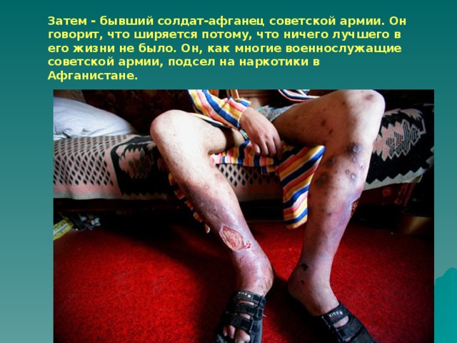 Затем - бывший солдат-афганец советской армии. Он говорит, что ширяется потому, что ничего лучшего в его жизни не было. Он, как многие военнослужащие советской армии, подсел на наркотики в Афганистане.