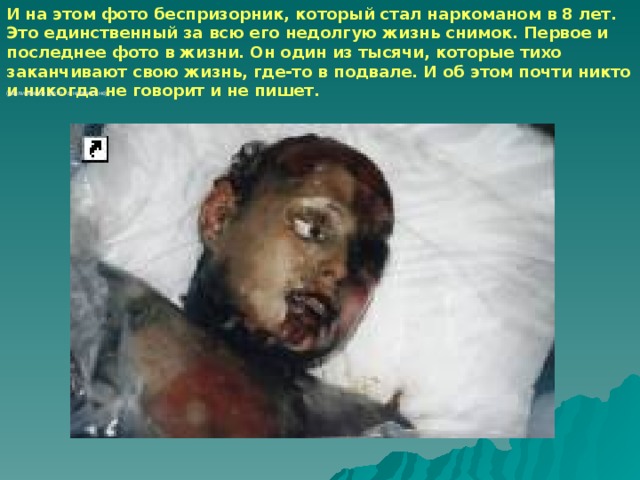 И на этом фото беспризорник, который стал наркоманом в 8 лет. Это единственный за всю его недолгую жизнь снимок. Первое и последнее фото в жизни. Он один из тысячи, которые тихо заканчивают свою жизнь, где-то в подвале. И об этом почти никто и никогда не говорит и не пишет.  (увеличенное фото - в новом окне)
