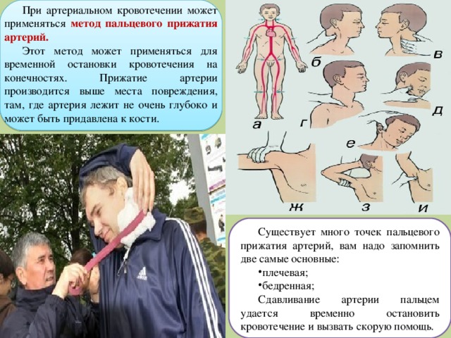 Оказание первой медицинской помощи при наружном кровотечении обж 7 класс презентация