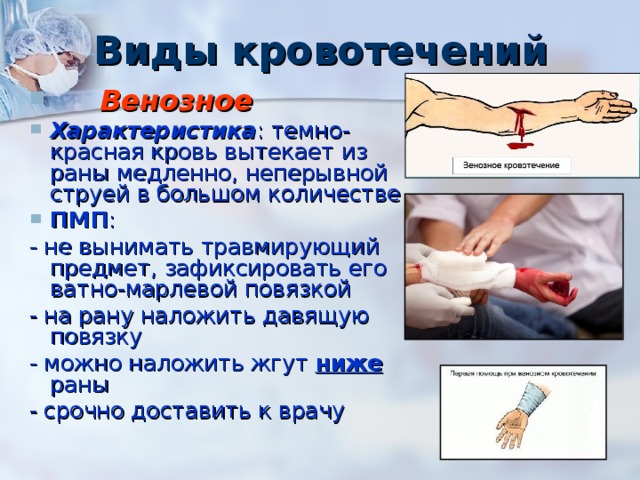 Виды кровотечений  Венозное Характеристика : темно-красная кровь вытекает из раны медленно, неперывной струей в большом количестве ПМП : - не вынимать травмирующий предмет, зафиксировать его ватно-марлевой повязкой - на рану наложить давящую повязку - можно наложить жгут ниже раны - срочно доставить к врачу 