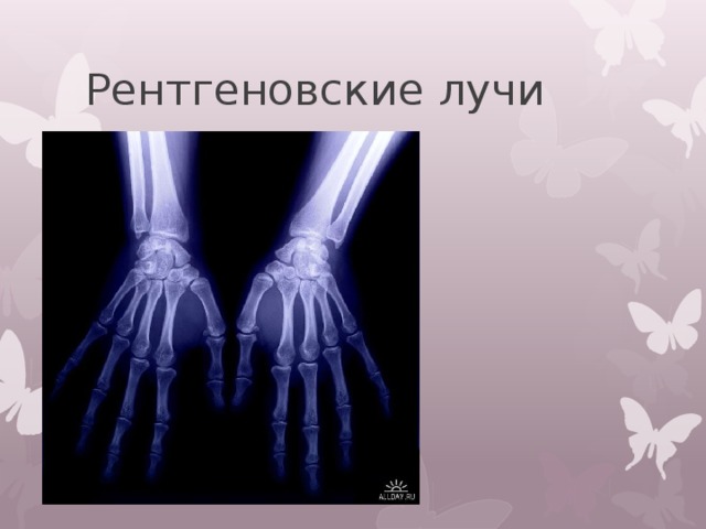 Рентгеновские лучи 