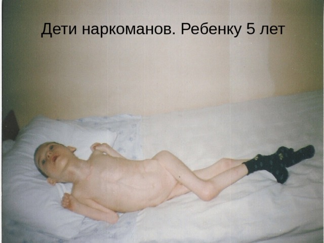 Дети наркоманов. Ребенку 5 лет 
