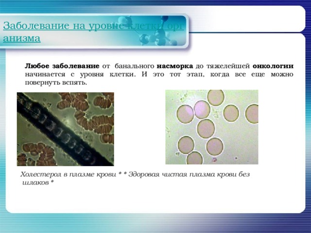 Любое заболевание от  банального насморка до тяжелейшей онкологии начинается с уровня клетки. И это тот этап, когда все еще можно повернуть вспять. Холестерол в плазме крови *  * Здоровая чистая плазма крови без шлаков *