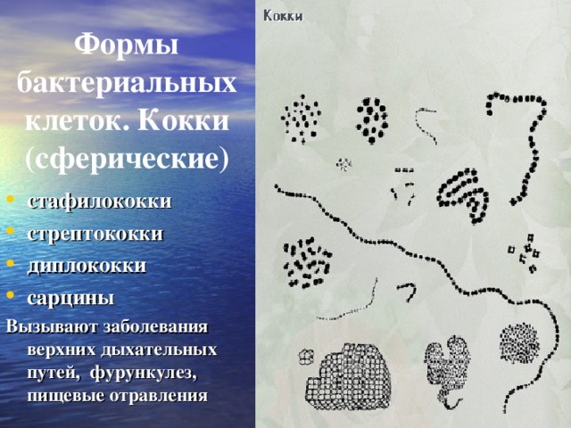 Формы бактериальных клеток. Кокки (сферические) стафилококки стрептококки диплококки сарцины Вызывают заболевания верхних дыхательных путей,  фурункулез,  пищевые отравления 